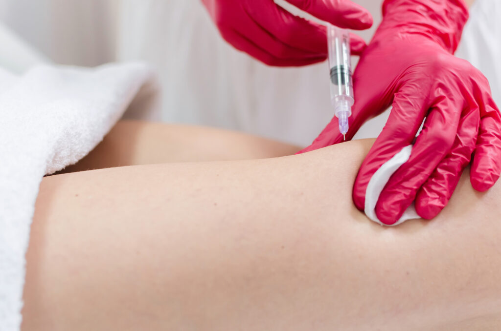 Aqualyx Fettentfernung Arzte und Laserzentrum